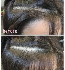つむじや前髪などの生えグセをを改善できるたった１つの技法とは 東京の縮毛矯正と髪質改善の専門店 Loslobos